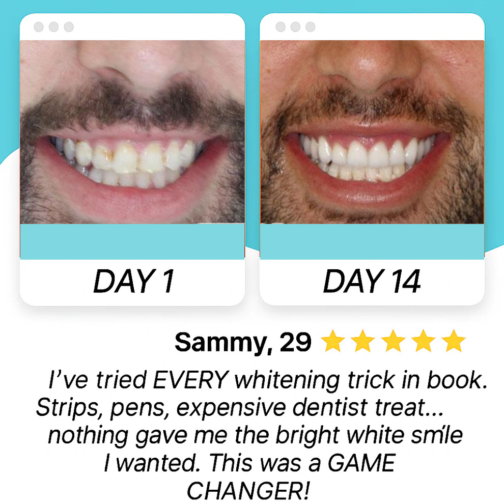 Brushly Automatic Sonic ToothBrush